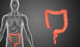 直肠腺癌能否吃哈密瓜